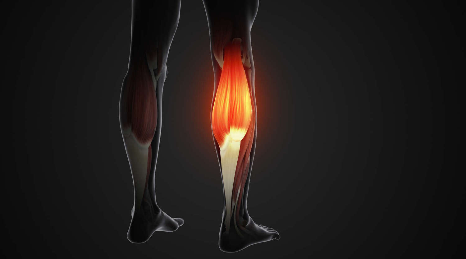 heat map of calf muscle 