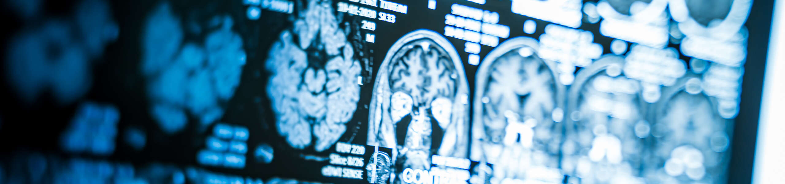 Close up of CT scan with brain and skull